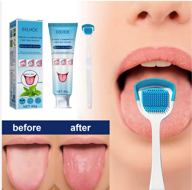 Gel de Nettoyage de Langue – Élimine la Mauvaise Haleine